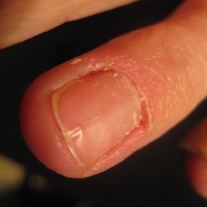removing acrylic nails nails thriftyfun removing removing diy acrylic nails acrylic