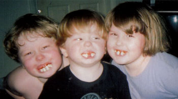 Goofy toothed  Kids