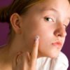 Woman applying acne cream to her face.