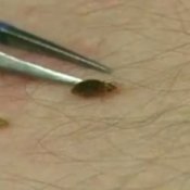 Treating Bed Bugs, Tweezers Picking up Bed Bug