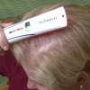 Hair Loss Treatments, Woman Using Hairmax treatment