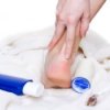 Calluses on Feet
