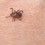 Tick on Skin