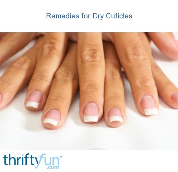 remedies-for-dry-cuticles-thriftyfun