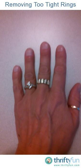 Wedding ring tight during pregnancy
