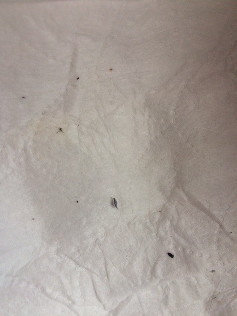 tiny bugs head hair human fleas dots itch making rid flakes thriftyfun getting carpet vidalondon ad