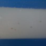 tiny orange bugs on white pole