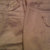 Black dye spots on shorts