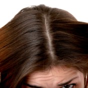 Woman Combing Dandruff from Her Hair