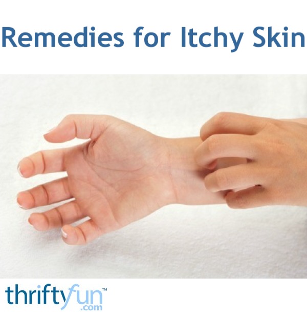 for skin solution itchy for   ThriftyFun Itchy Skin Remedies