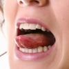 A woman with a pimple on her tongue.