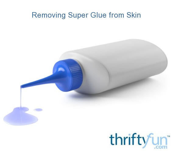 Removing Super Glue From Skin Thriftyfun