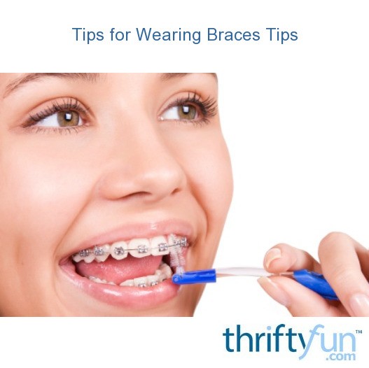 Tips for Wearing Braces ThriftyFun