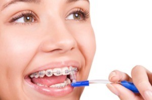 Wearing Braces Tips