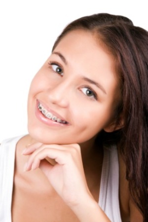 girl with braces