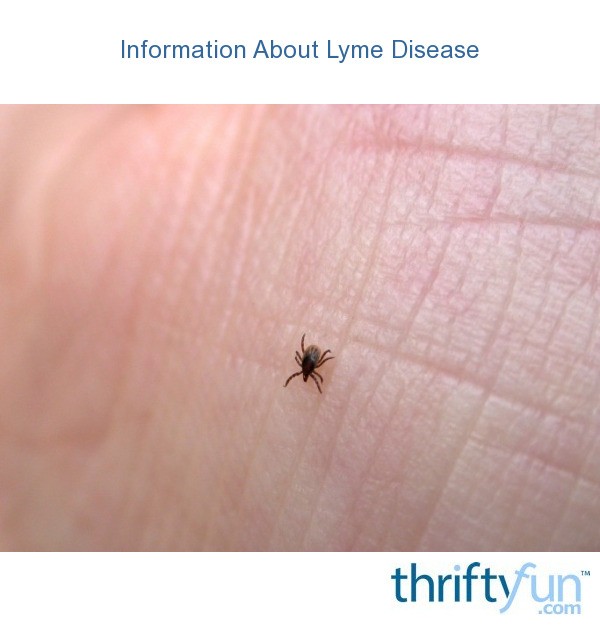 Information About Lyme Disease? | ThriftyFun