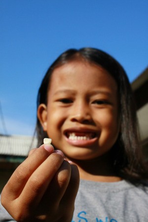 Girl Holding her Lost Tooth