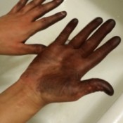 brown hair dye on hands