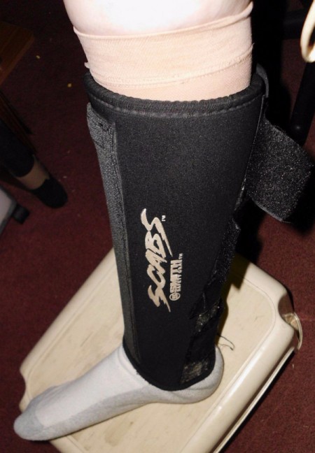 Preventing Leg Ulcers with Shin Guards