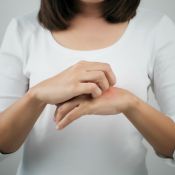 woman scratching patch of red irritated skin on back of hand