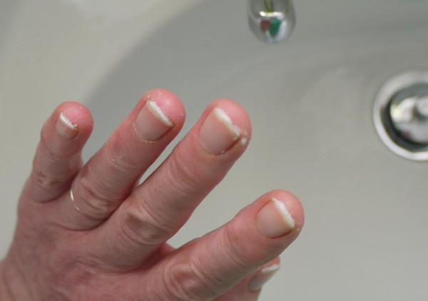 Cleaning Fingernails After Gardening