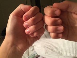 Oddly Shaped Nails From Biting