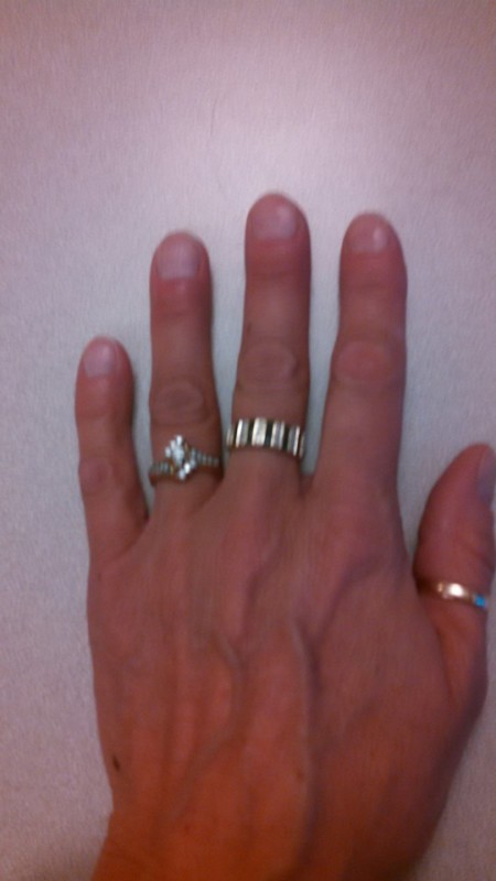 Removing Too Tight Rings