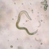 Image of a nematode shown under microscope