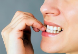 Close up of woman's teeth biting her finger nails