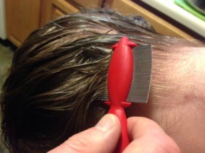 Natural Remedies for Head Lice