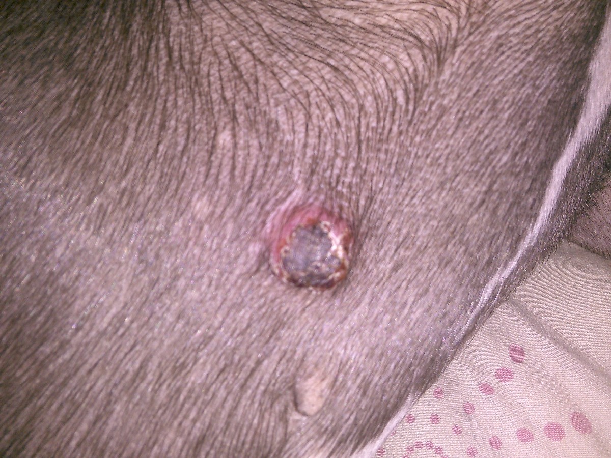 Round Bumps On Skin