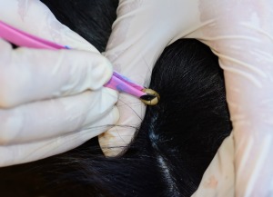 Gloved hands holding silver tweezers with freshly removed tick