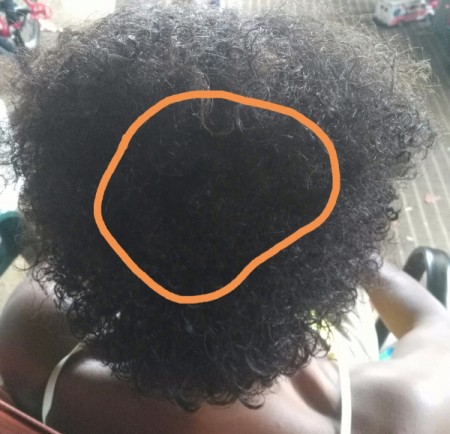 Remedy For Hair Damaged By Relaxer Thriftyfun