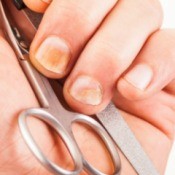 Remedies for Yellow Fingernails