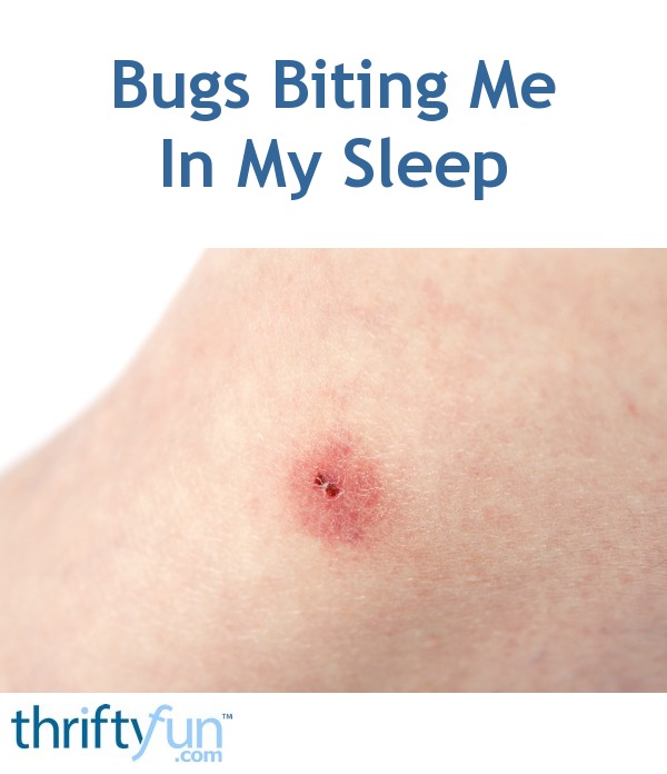 Bugs Biting Me In My Sleep Thriftyfun