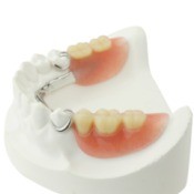Partial Dentures on white tooth mould