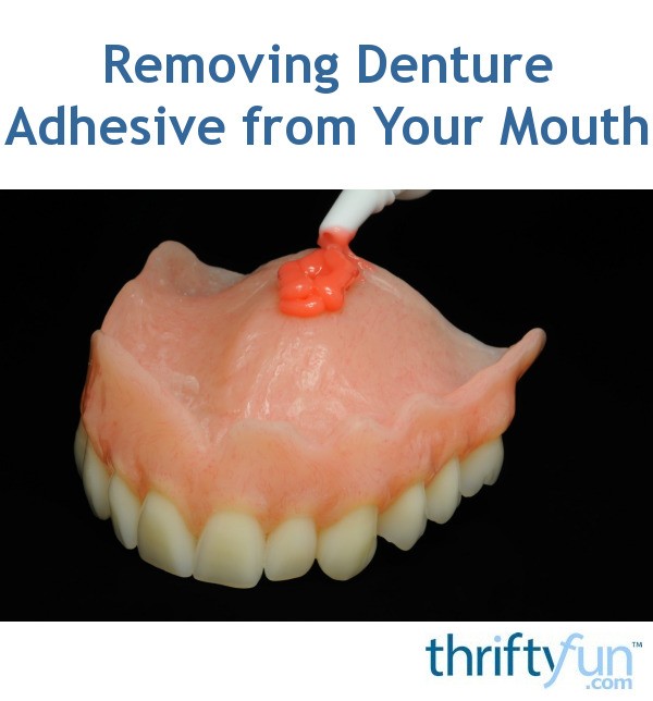 Removing Denture Adhesive from Your Mouth ThriftyFun