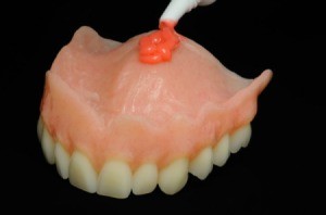 Top Dentures with Adhesive being applied