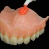 Top Dentures with Adhesive being applied