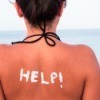 A woman with a sunburned back.