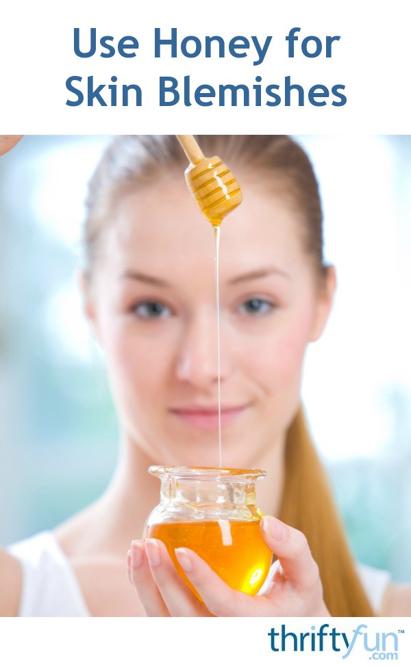 How to Use Honey for Skin Blemishes ThriftyFun