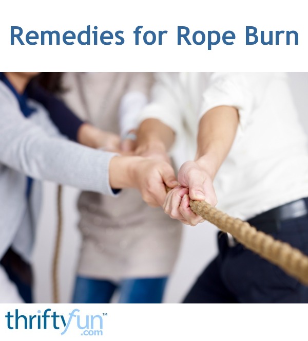 treating a rope burn