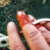 Wear Gardening Gloves For The Unexpected - cut finger