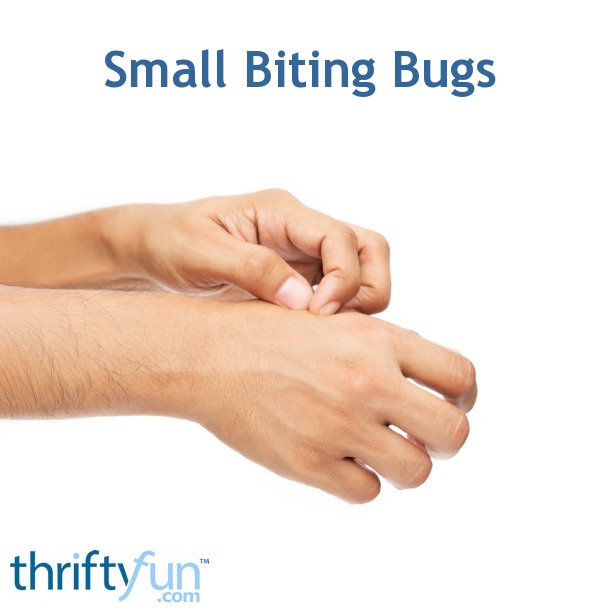 Identifying Small White Biting Bugs | ThriftyFun