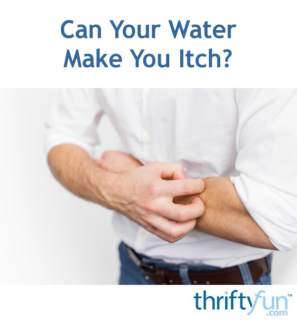 can-your-water-make-you-itch-thriftyfun