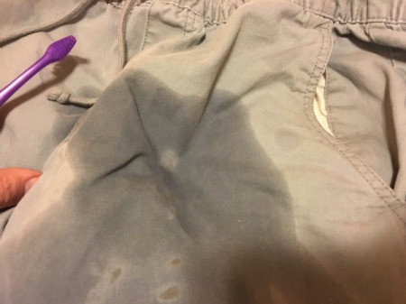 Peroxide for Removing Blood Stains - peroxide bubbling