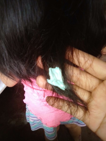 A piece of gum that needs to be removed from a child's hair.