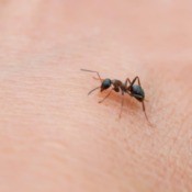 An ant crawling a person's skin.