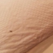 Identifying Tiny Black Bugs