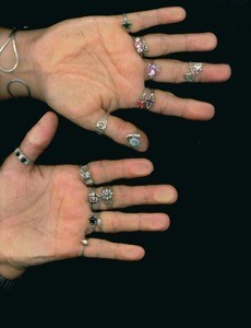 A picture of many rings on two hands, on a black background.